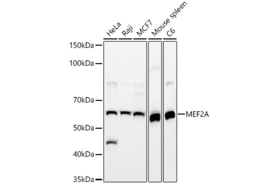 Western Blot - Anti-MEF2A Antibody (A90391) - Antibodies.com