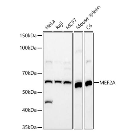 Western Blot - Anti-MEF2A Antibody (A90391) - Antibodies.com