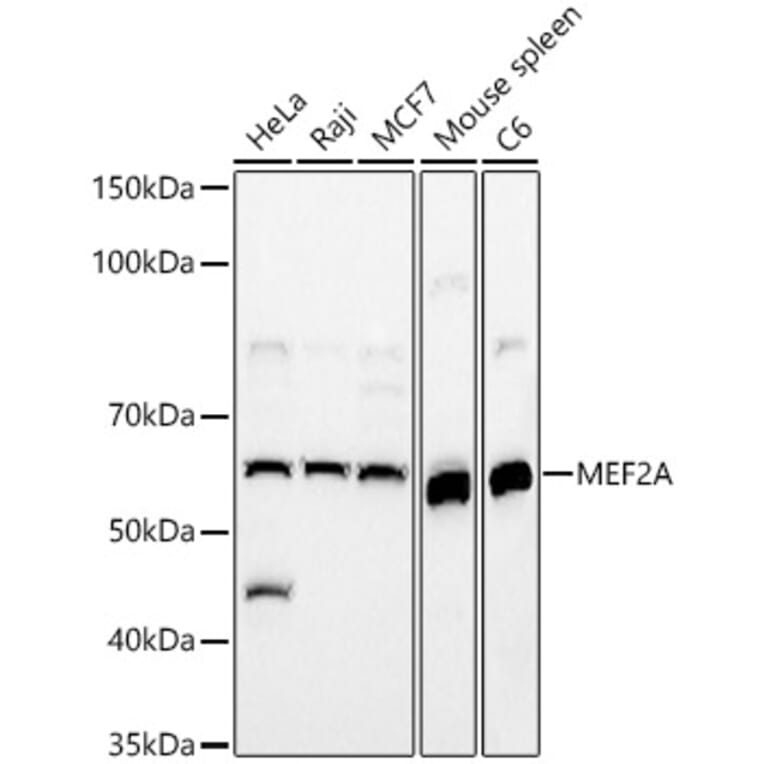 Western Blot - Anti-MEF2A Antibody (A90391) - Antibodies.com