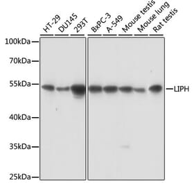 Western Blot - Anti-LIPH Antibody (A90392) - Antibodies.com
