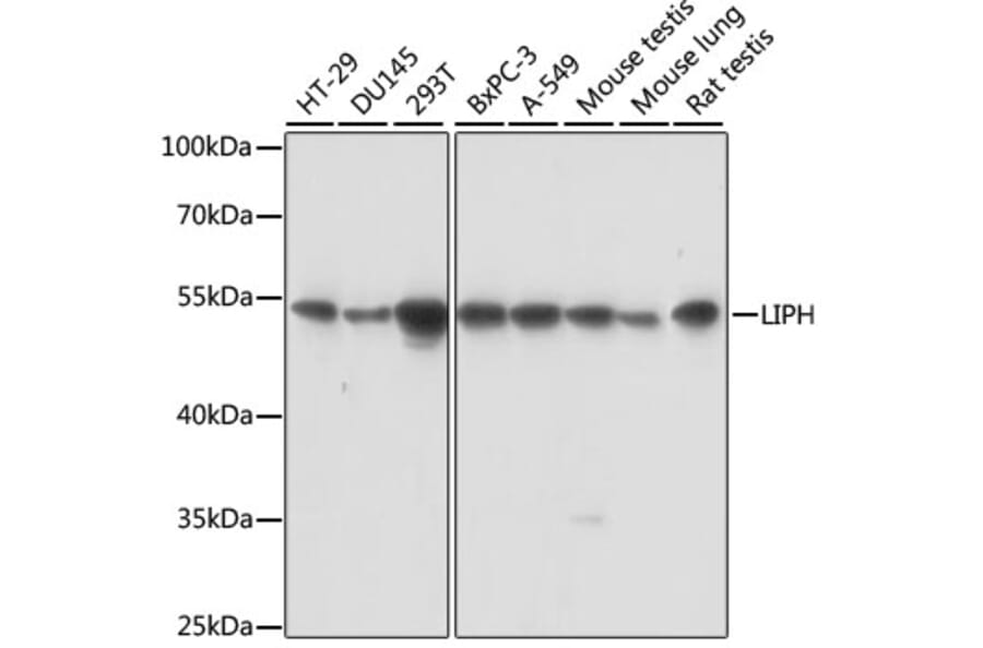 Western Blot - Anti-LIPH Antibody (A90392) - Antibodies.com