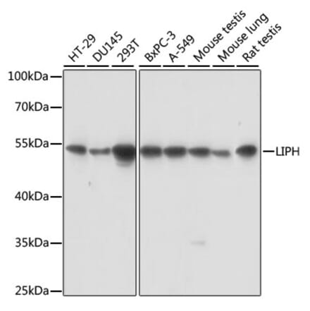 Western Blot - Anti-LIPH Antibody (A90392) - Antibodies.com