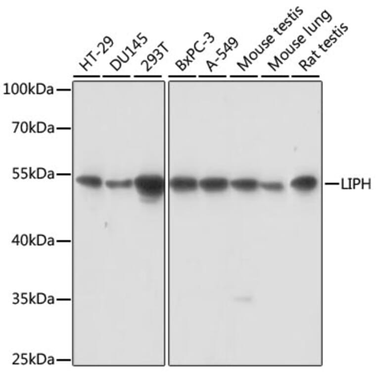 Western Blot - Anti-LIPH Antibody (A90392) - Antibodies.com