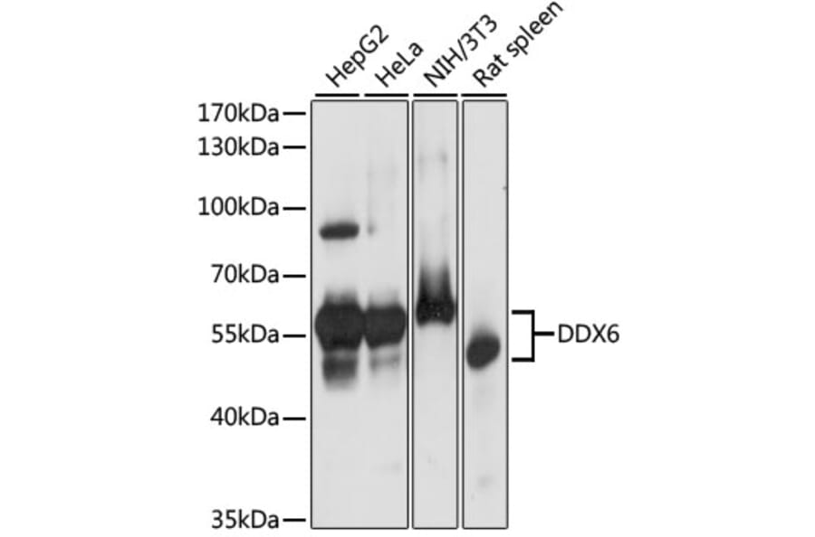 Western Blot - Anti-DDX6 Antibody (A90393) - Antibodies.com