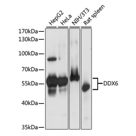 Western Blot - Anti-DDX6 Antibody (A90393) - Antibodies.com