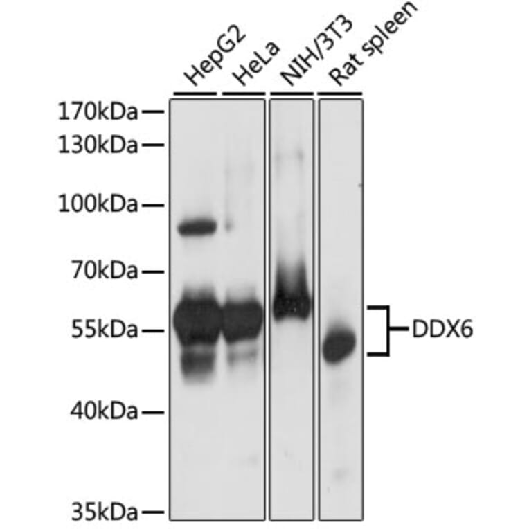 Western Blot - Anti-DDX6 Antibody (A90393) - Antibodies.com