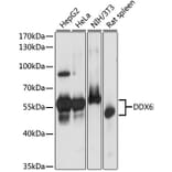 Western Blot - Anti-DDX6 Antibody (A90393) - Antibodies.com