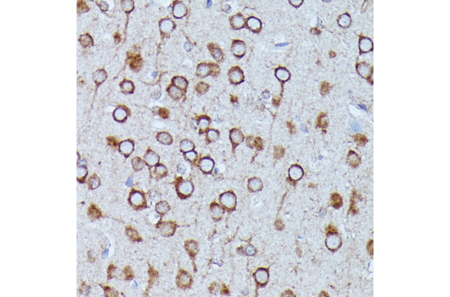 Immunohistochemistry - Anti-DDX6 Antibody (A90393) - Antibodies.com