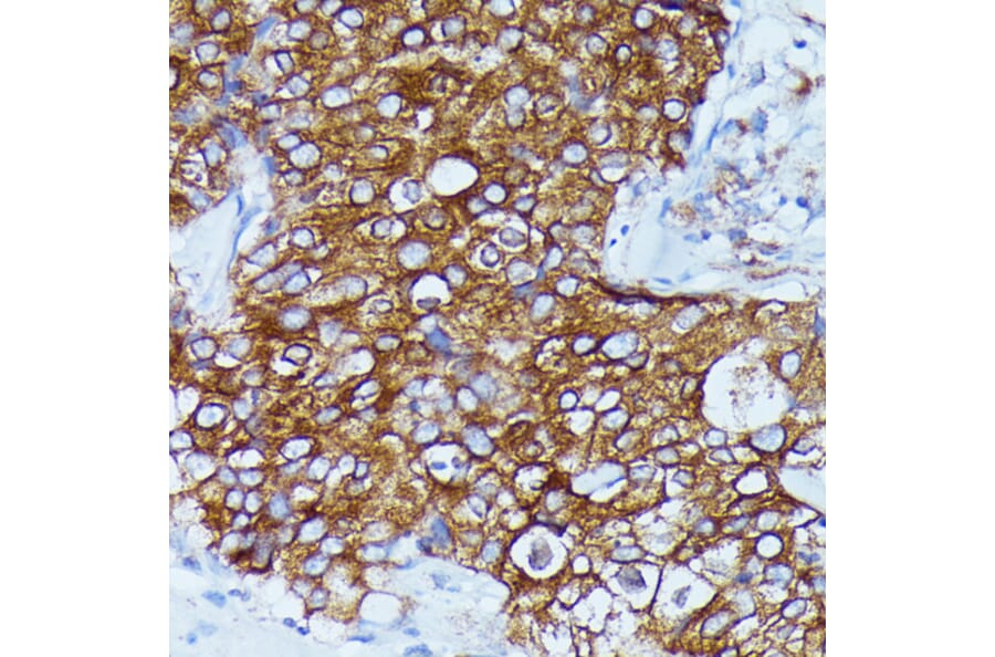 Immunohistochemistry - Anti-DDX6 Antibody (A90393) - Antibodies.com