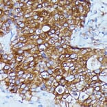 Immunohistochemistry - Anti-DDX6 Antibody (A90393) - Antibodies.com