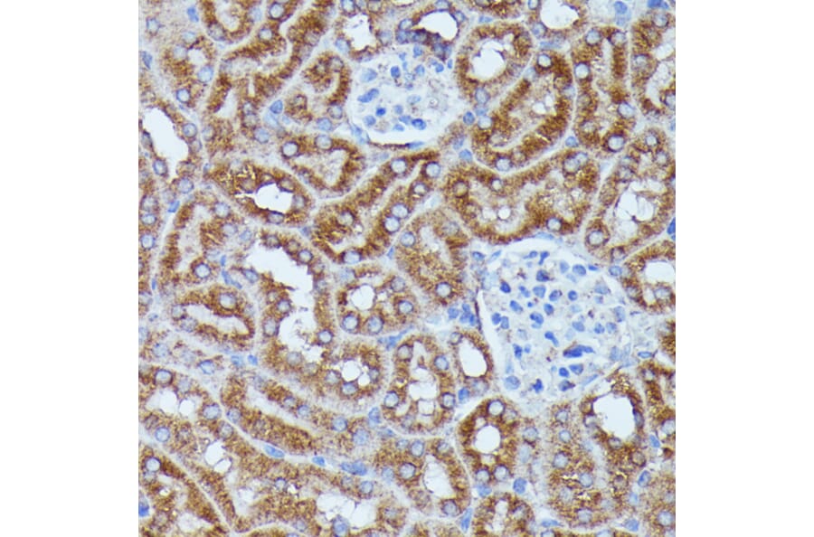 Immunohistochemistry - Anti-DDX6 Antibody (A90393) - Antibodies.com