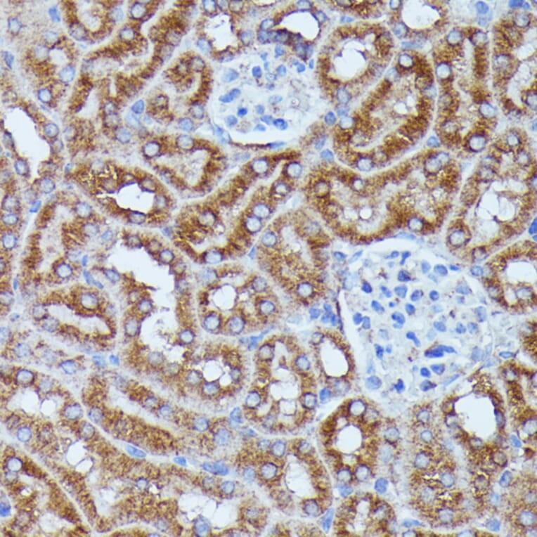 Immunohistochemistry - Anti-DDX6 Antibody (A90393) - Antibodies.com