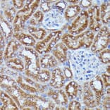 Immunohistochemistry - Anti-DDX6 Antibody (A90393) - Antibodies.com