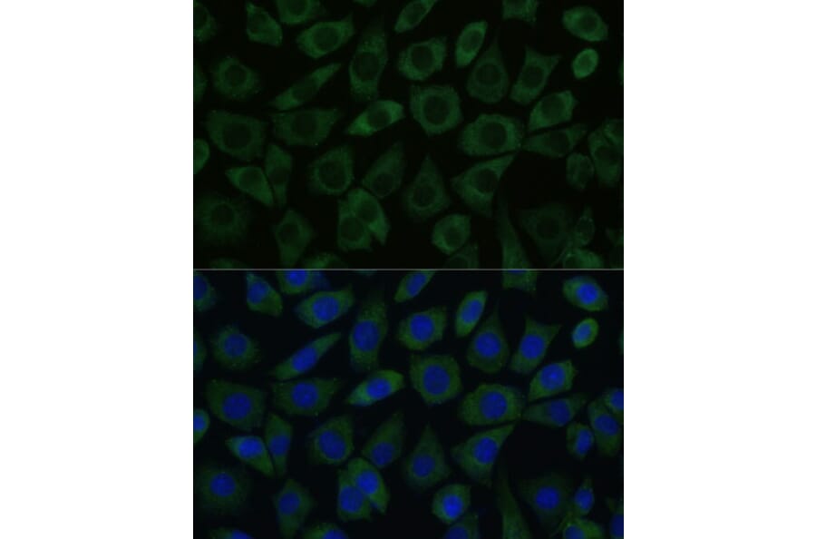 Immunofluorescence - Anti-DDX6 Antibody (A90393) - Antibodies.com