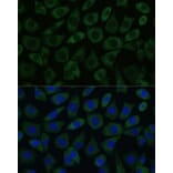 Immunofluorescence - Anti-DDX6 Antibody (A90393) - Antibodies.com