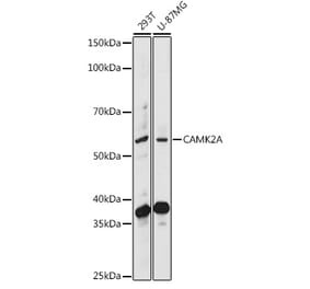 Western Blot - Anti-CaMKII alpha Antibody (A90394) - Antibodies.com