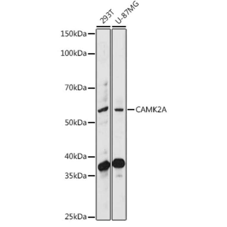 Western Blot - Anti-CaMKII alpha Antibody (A90394) - Antibodies.com