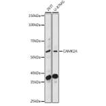 Western Blot - Anti-CaMKII alpha Antibody (A90394) - Antibodies.com
