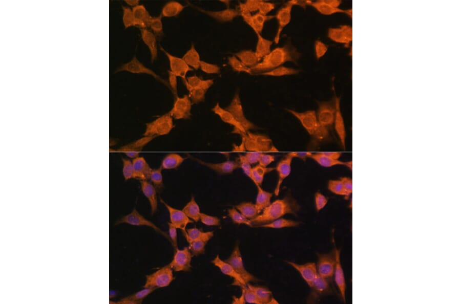 Immunofluorescence - Anti-CaMKII alpha Antibody (A90394) - Antibodies.com
