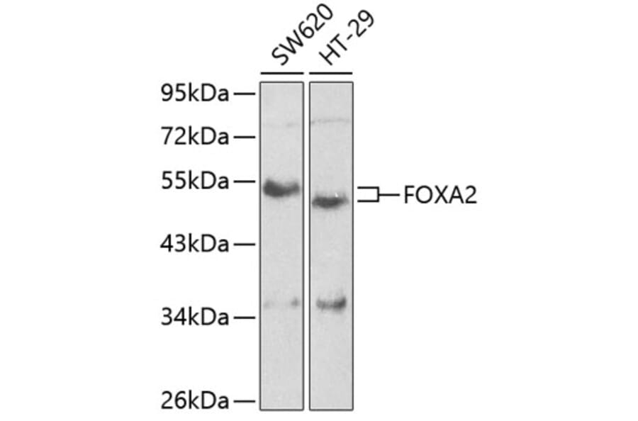 Western Blot - Anti-FOXA2 Antibody (A2923) - Antibodies.com