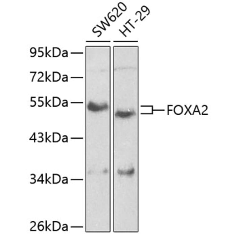 Western Blot - Anti-FOXA2 Antibody (A2923) - Antibodies.com
