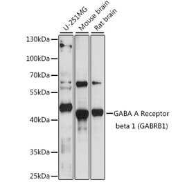 Western Blot - Anti-GABRB1 Antibody (A90396) - Antibodies.com