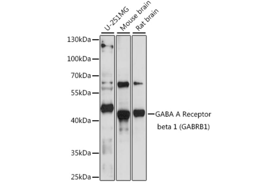 Western Blot - Anti-GABRB1 Antibody (A90396) - Antibodies.com