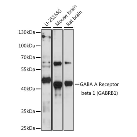 Western Blot - Anti-GABRB1 Antibody (A90396) - Antibodies.com
