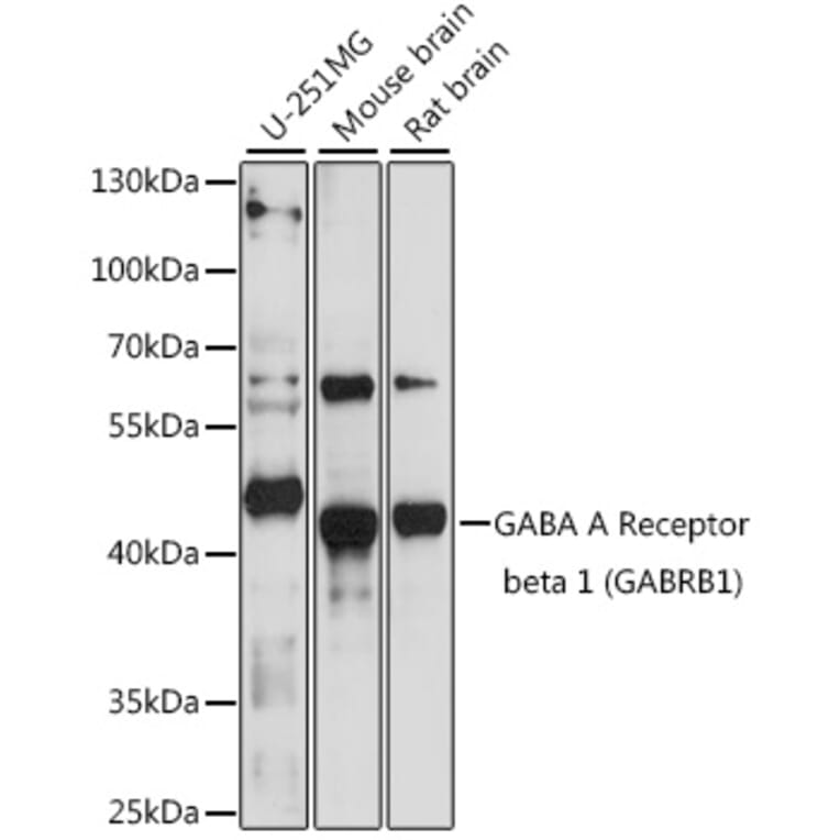 Western Blot - Anti-GABRB1 Antibody (A90396) - Antibodies.com