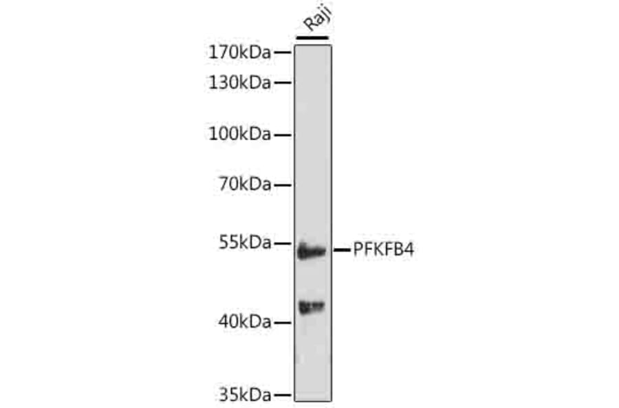 Western Blot - Anti-PFKFB4 Antibody (A16254) - Antibodies.com
