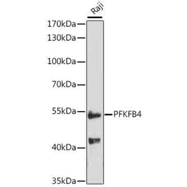 Western Blot - Anti-PFKFB4 Antibody (A16254) - Antibodies.com