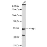 Western Blot - Anti-PFKFB4 Antibody (A16254) - Antibodies.com