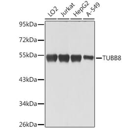 Western Blot - Anti-TUBB8 Antibody (A90398) - Antibodies.com
