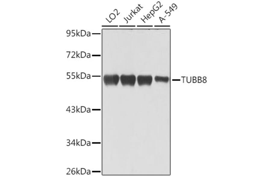 Western Blot - Anti-TUBB8 Antibody (A90398) - Antibodies.com