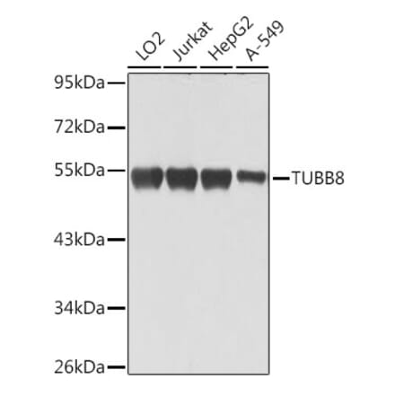 Western Blot - Anti-TUBB8 Antibody (A90398) - Antibodies.com
