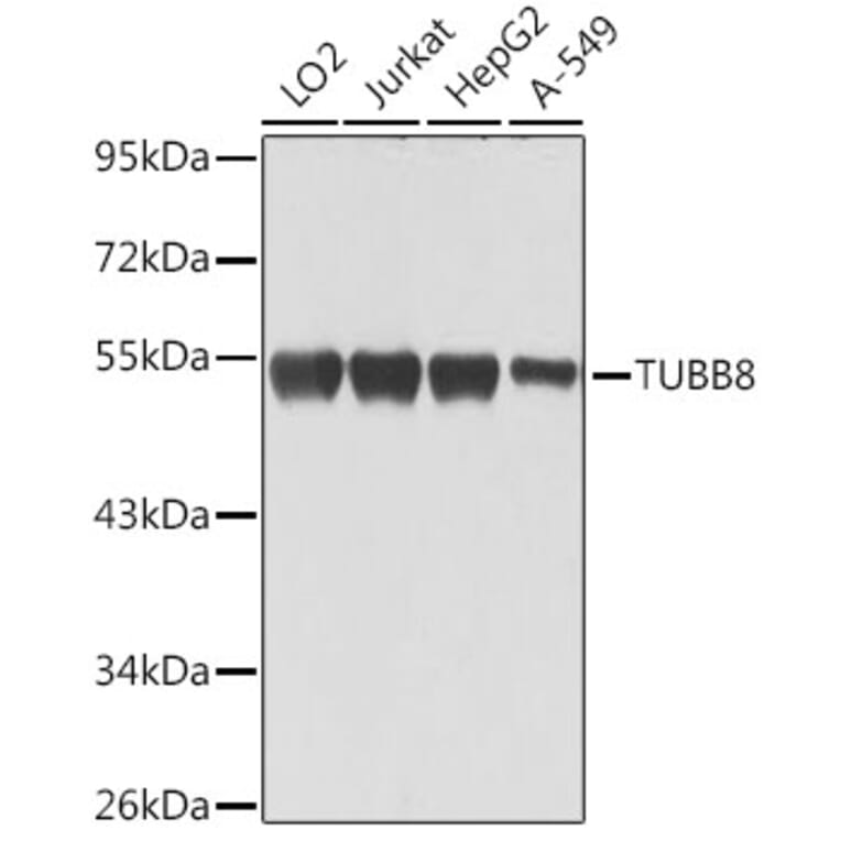 Western Blot - Anti-TUBB8 Antibody (A90398) - Antibodies.com