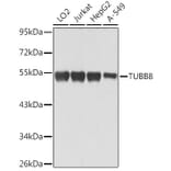 Western Blot - Anti-TUBB8 Antibody (A90398) - Antibodies.com