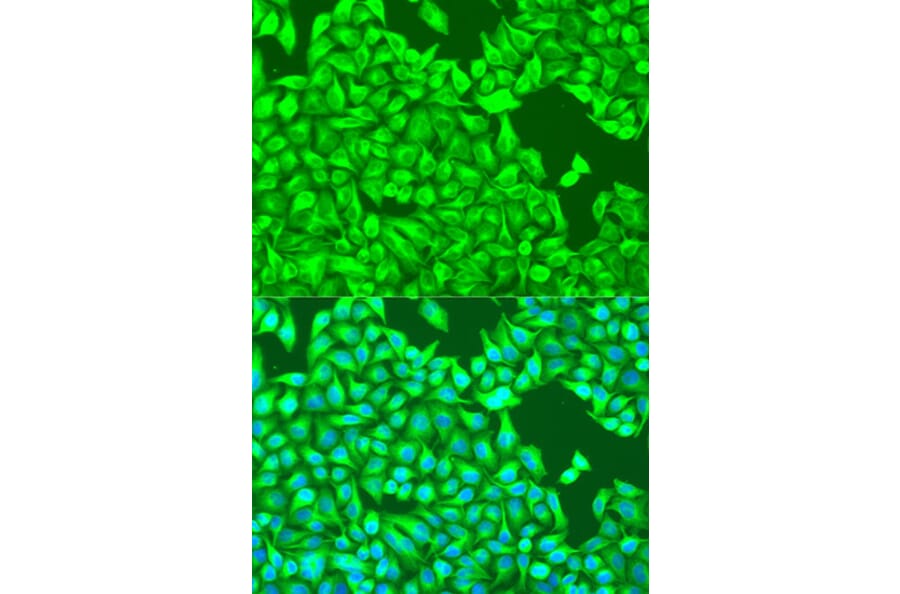 Immunofluorescence - Anti-TUBB8 Antibody (A90398) - Antibodies.com