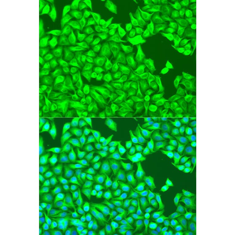 Immunofluorescence - Anti-TUBB8 Antibody (A90398) - Antibodies.com