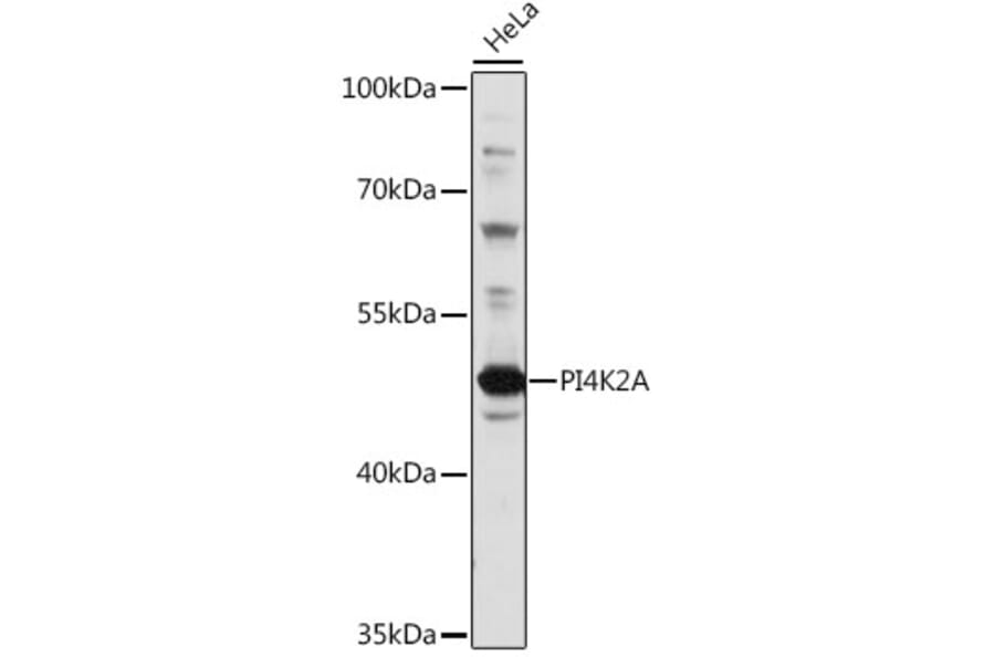 Western Blot - Anti-PI4K2A Antibody (A90399) - Antibodies.com