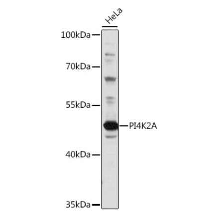 Western Blot - Anti-PI4K2A Antibody (A90399) - Antibodies.com