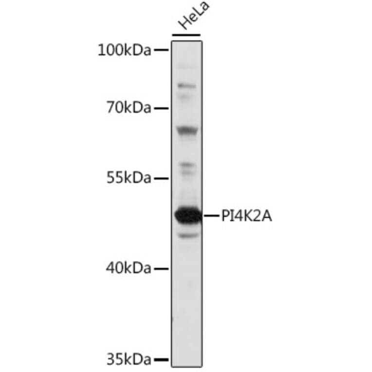 Western Blot - Anti-PI4K2A Antibody (A90399) - Antibodies.com