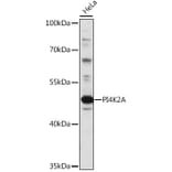 Western Blot - Anti-PI4K2A Antibody (A90399) - Antibodies.com