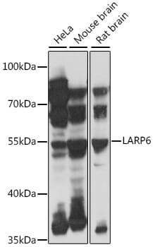 Western blot analysis of extracts of various cell lines, using Anti-LARP6 Antibody (A16330) at 1:1,000 dilution.
Secondary antibody: Goat Anti-Rabbit IgG (H+L) (HRP) (AS014) at 1:10,000 dilution.
Lysates / proteins: 25µg per lane.
Blocking buffer: 3% non-fat dry milk in TBST.
Detection: ECL Basic Kit (RM00020).
Exposure time: 3s.