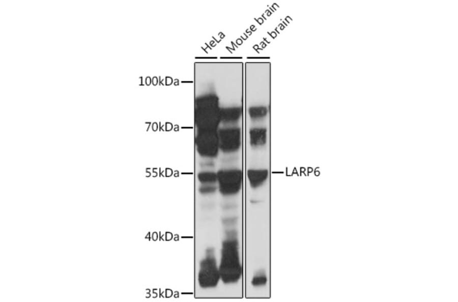 Western Blot - Anti-LARP6 Antibody (A90400) - Antibodies.com