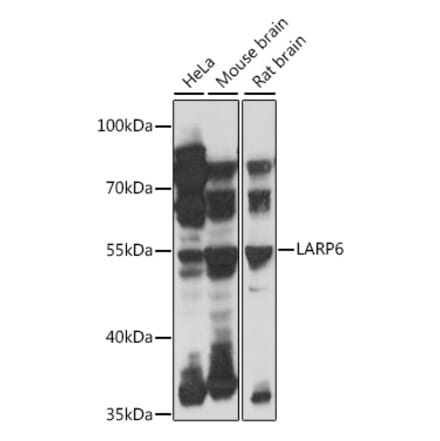 Western Blot - Anti-LARP6 Antibody (A90400) - Antibodies.com