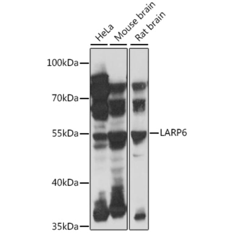 Western Blot - Anti-LARP6 Antibody (A90400) - Antibodies.com