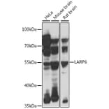 Western Blot - Anti-LARP6 Antibody (A90400) - Antibodies.com