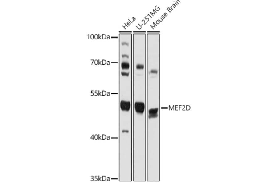 Western Blot - Anti-MEF2D Antibody (A90402) - Antibodies.com