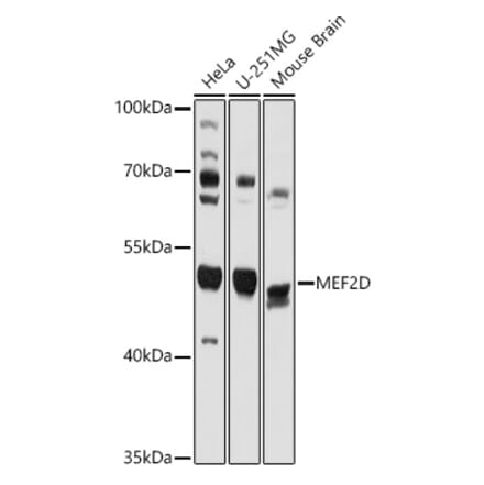 Western Blot - Anti-MEF2D Antibody (A90402) - Antibodies.com